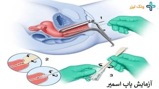 همه چیز در مورد زگیل تناسلی زنان