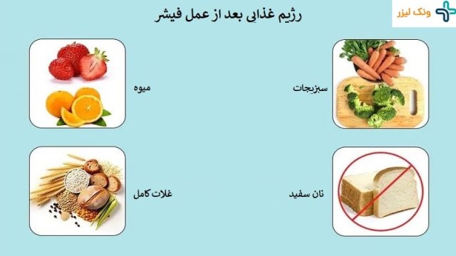 اقدامات لازم بعد از جراحی فیشر