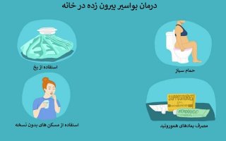 درمان خانگی هموروئید بیرون زده