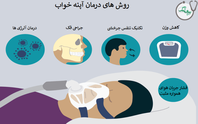 درمان بیماری آپنه خواب