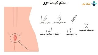 سینوس مویی چیست (+روش های درمان)