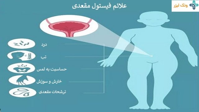 فیستول چیست {علت ایجاد آن در زنان و مردان}