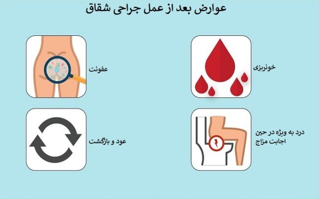 11 عوارض جانبی عمل جراحی شقاق که از آنها خبر ندارید