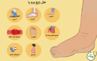 چرا پا ورم می کند؟ (ورم پا نشانه چه مشکلی است؟)