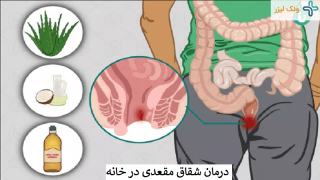 بهترین و سریعترین درمان های خانگی شقاق