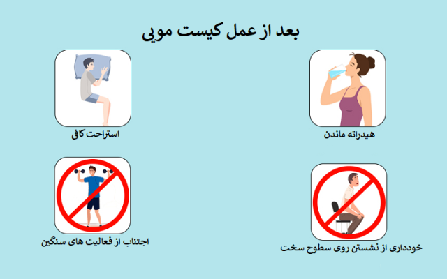 مراقبت های بعد از عمل کیست مویی چیست؟